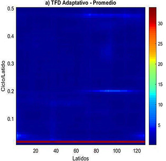 Figura 3. TFD adaptativo promedio de la se&ntilde;al TWADB55 correspondiente a una se&ntilde;al de un paciente sano; a 0,5 cpl se observa valores bajo de alternancia.