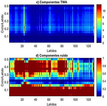 Figura 6. Descomposici&oacute;n de la se&ntilde;al TWADB12 en sus componentes alternantes y ruido.