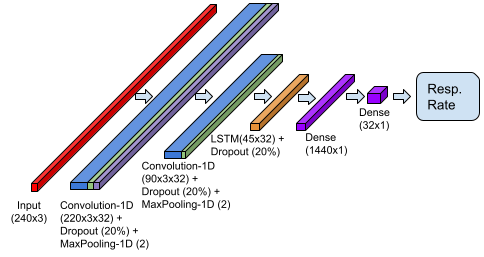 Arquitectura de red neuronal seleccionada