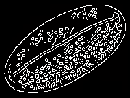 
               Imagen procesada por el detector de bordes Canny.