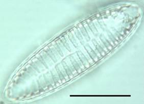 The diatom Surirella angusta. Scale bar: 20 micrometers. K. Haberyan