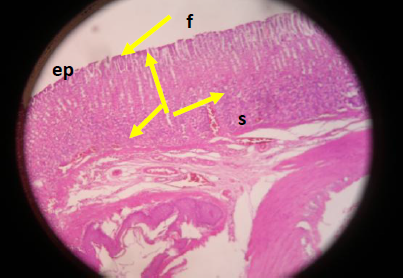  Est&oacute;mago rata
irradiado sin trigo. Rata. Est&oacute;mago. Superior: mucosa g&aacute;strica mostrando la
superficie del epitelio con p&eacute;rdida de microvellosidades (ep), pocas fov&eacute;olas aperturadas (f). Presencia de vasos sangu&iacute;neos
dilatados (vs), que obedece a la irritaci&oacute;n radioactiva
. H&E (x100)