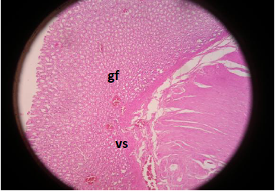  Est&oacute;mago rata
irradiado sin trigo. Rata. Est&oacute;mago. Mucosa g&aacute;strica con p&eacute;rdida de gl&aacute;ndulas y
fov&eacute;olas aperturadas (gf). Presencia de vasos sangu&iacute;neos dilatados en el fundus (vs), que obedece irradiaci&oacute;n y en respuesta
angiog&eacute;nesis. H&E (x100)