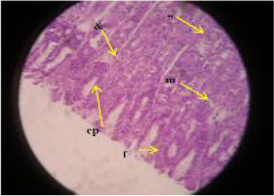 Est&oacute;mago rata
irradiado con trigo Rata. Est&oacute;mago. Detalle de mucosa g&aacute;strica mostrando las
entradas de las fov&eacute;olas (f) recubiertas por
un epitelio prism&aacute;tico alto monoestratificado (ep). Gl&aacute;ndulas fundidas con presencia de c&eacute;lulas parietales
ox&iacute;nticas (&) y c&eacute;lulas principales cim&oacute;genas
(#). Escasa presencia de c&eacute;lulas mucosas (m). H&E (x400) Muy
probable la radiaci&oacute;n provoque lesi&oacute;n a c&eacute;lulas mucosas.