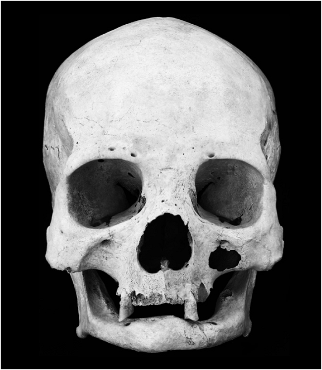 G&oacute;mez Vald&eacute;s.