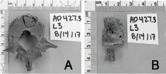 Ejemplo de documentaci�n fotogr�fica durante el muestreo de elementos �seos patol�gicos para el an�lisis de adn antiguo. Antes (a) y despu�s (b) de la toma de muestra.