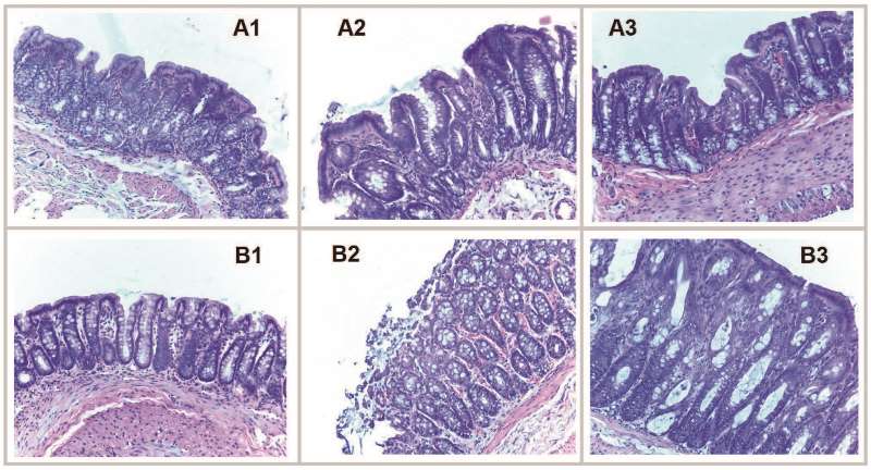 Características histológicas de dos secciones de colon de ratas hembras una próxima al ciego A y la otra al recto B Hematoxilinaeosina 200X