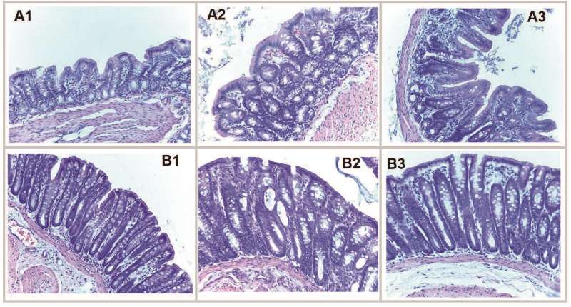 Características histológicas de dos secciones de colon de ratas machos una próxima al ciego A y la otra al recto B Hematoxilinaeosina 200X