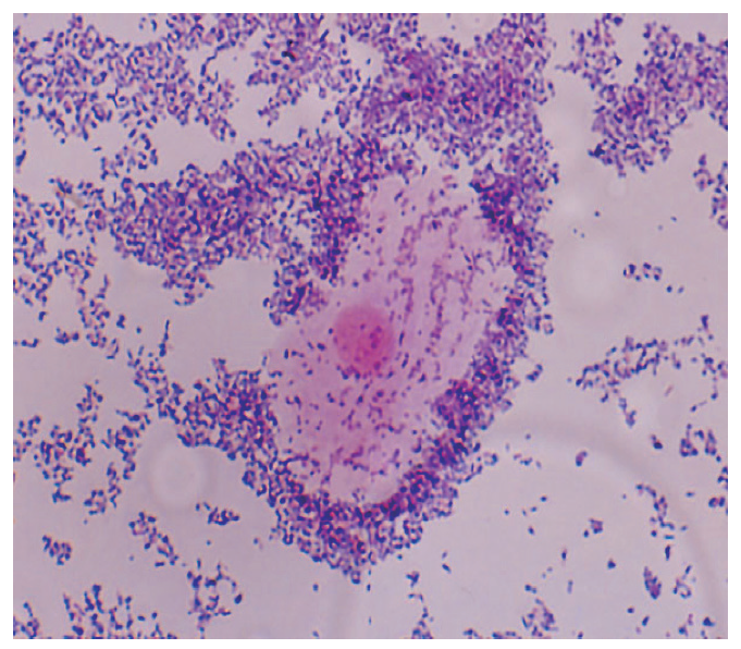 C�lulas gu�a o clue cells