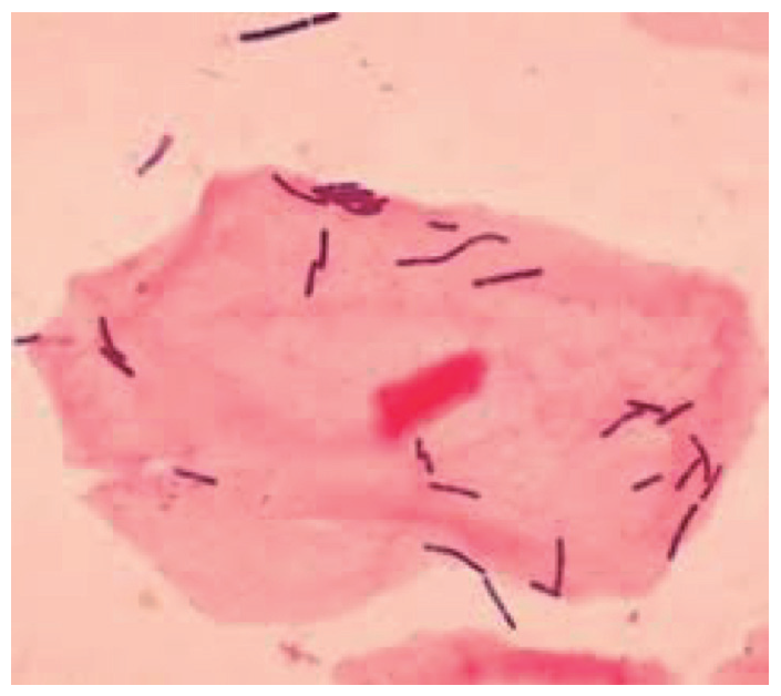 C�lula epitelial con lactobacilos