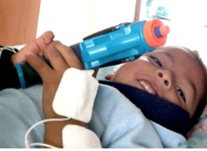 Pistolas Nerf adaptadas para distraer durante la electroestimulacin