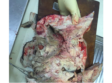 Corte de secci&oacute;n de tumoraci&oacute;n de mama con &aacute;reas de hemorragia.