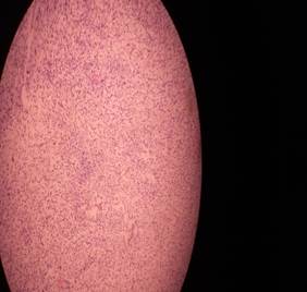 Tejido estromal con presencia de ductos mamarios en la porci&oacute;n central.