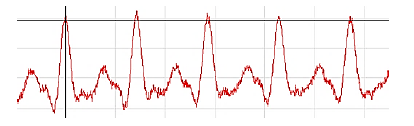 Waveform of the noise signal under the threshold.