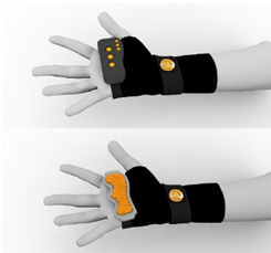 Vista en conjunto del instrumento terapéutico.