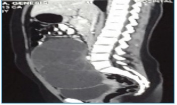 Tomografa Computada de Abdomen