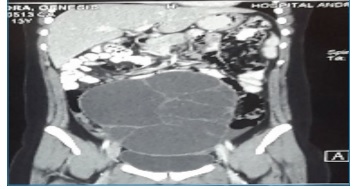 Pieza Quirrgica macroscopica