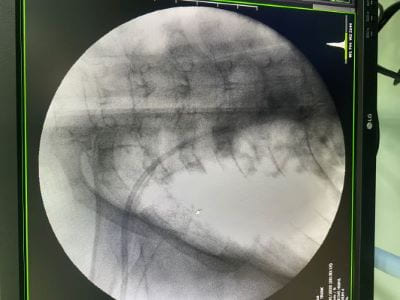 Fluoroscopic screen