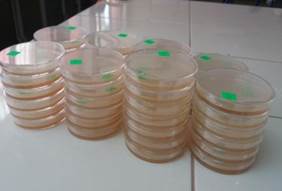 Siembra microbiol&oacute;gica. 