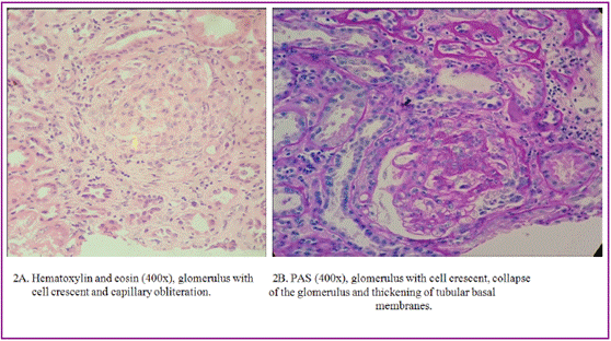 Image of kidney biopsy by light microscopy