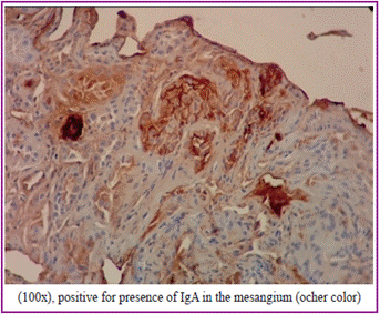 Image of kidney biopsy, immunohistochemistry.