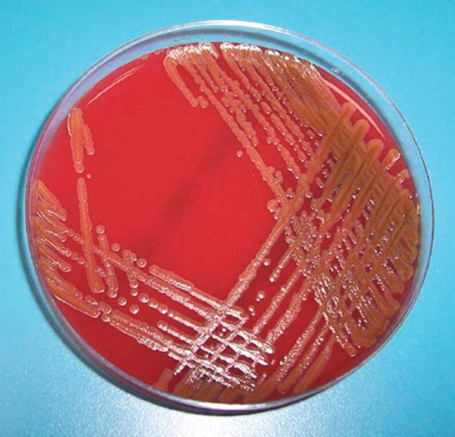 Cultivo en agar sangre para C. indologenes. Fotografía autorizada por la Dra. Andrea Sakurada Z, Hospital Clínico U. de Chile5.