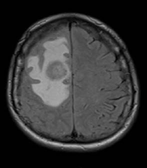 T2 resonancia magntica nuclear cerebral corte transversal.