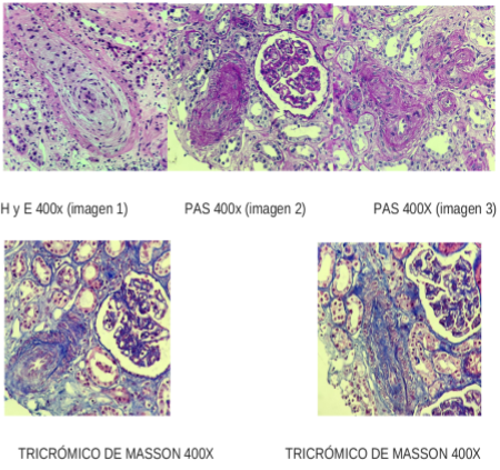 Imgenes de anatoma patolgica