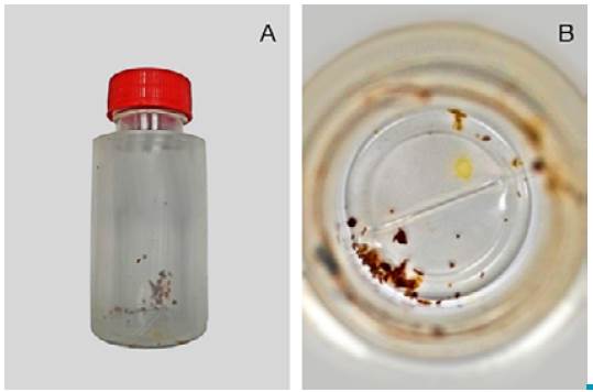A. Jar brought to the appointment by the patient. B. Close up of the jar contents.