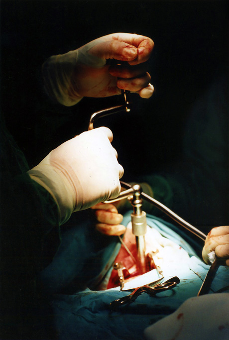 "Cirug&iacute;a". Serie Conceptos Vitales (2001). Fotograf&iacute;a a color. Kodak film Gold Max ASA 100 sobre papel fotogr&aacute;fico Kodak