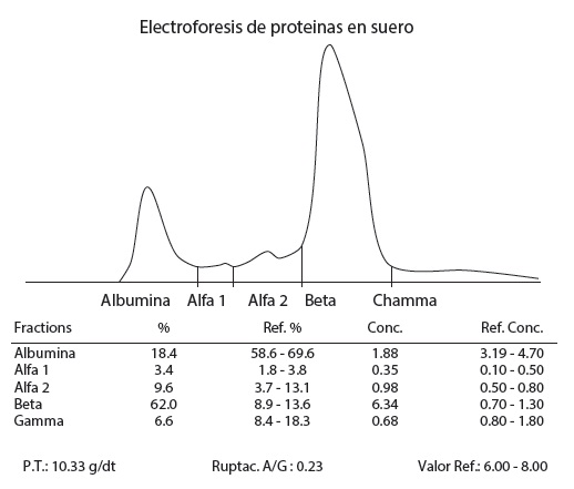 Proteinograma electrofor&eacute;tico