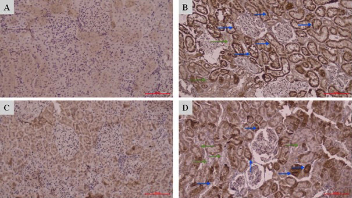 Kidney tissue sections stained using antiCaspase3 primary antibody by IHC method