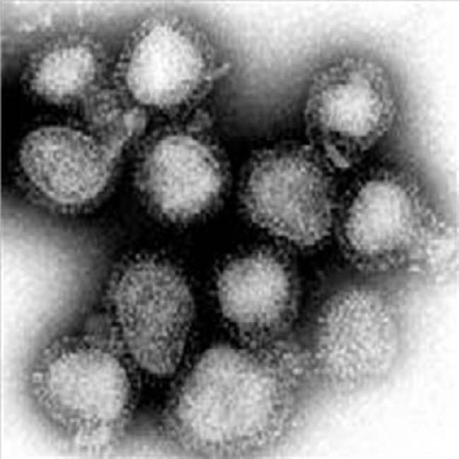 Influenzavirus A Subtipo H3N2, virus causante de la Gripe de Honk Kong.