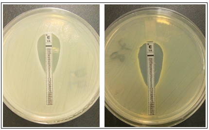 E-test result for determine the MIC to vancomycin