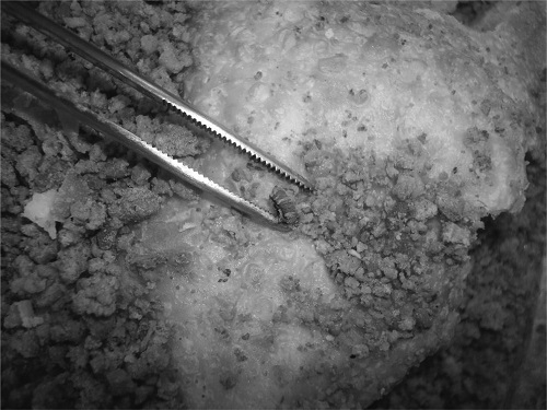 Macro-analytical examination of the foreign matter sample, showing grey fragments suspected to be papilla of animal origin.