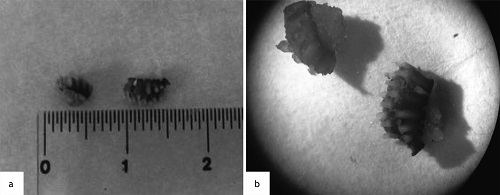 Size of the taste bud fragments found in the product (meat pasty), as observed by the naked eye (a) and under a stereoscopic microscope (b) under 30x magnification.
