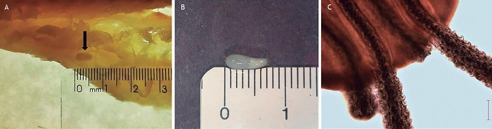 Cestódeos da Ordem Trypanorhyncha isolados de
Gadus chalcogrammus. (A) Vista macroscópica do espécime no filé, em mesa de luz. (B) Metacestóide observado em microscópio estereoscópico. (C) Detalhe microscópico do tentáculo com ganchos. Barra de escala C = 100 µm.
