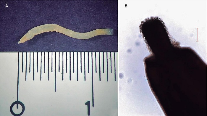 Larva de Acantocéfalo isolada de
Gadus chalcogrammus. (A) Visualização em microscópio estereoscópico. (B) Detalhe microscópico da probóscide com ganchos na extremidade anterior. Barra de escala B = 100 µm.