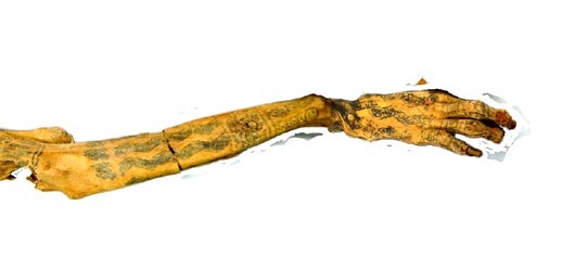 Im&aacute;genes del brazo y antebrazo de la Se&ntilde;ora de Cao.