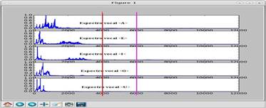 Espectro normalizado de la vocales patrón (frecuencia)
