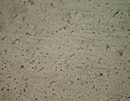 Microfotografía de material soldado a una velocidad de avance de 500mm/min.
