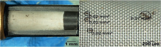 Malla de microfiltro del inyector Aveo (zoom: 1.25x, 5x, combustible 87 % octano)