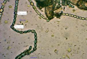Identification of Anabena azollae.