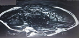 Resonancia magnética nuclear