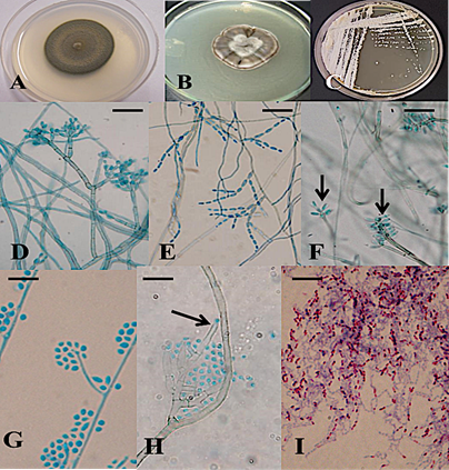 Morfolog&iacute;a de aislados obtenidos de plantas y suelos del estado de Puebla. Colonias de Cladophialophora carrionii (A: pigmentada, vellosa), Sporothris schenckii (B: variedad pigmentada, membranosa) y Nocardia brasiliensis (C: aspecto c&eacute;reo, color naranja). Examen microsc&oacute;pico contrastado con azul de lactofenol de Fonsecaea pedrosoi (D: conidi&oacute;foros ramificados, con cadenas cortas de conidios), C. carrionii (E: cadenas largas de conidios), Rhinocladiela aquaspersa (F: conidios alargados (flechas) formados en el extremo de conidi&oacute;foros simples), S. schenckii (G: conidi&oacute;foros largos en cuyo extremo se forman simpoduloconidios ovoides) y Madurella mycetomatis (H: fi&aacute;lides casi transparentes (flecha) de donde surgen peque&ntilde;os conidios). Frotis de N. brasiliensis te&ntilde;ido con Kinyoun (I: filamentos bacterianos, con estructuras cocoides y bacilares). (Im&aacute;genes D a I: tomadas a 100X). Barra de escala: 20 &micro;m.