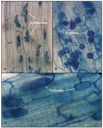 Estructuras microsc&oacute;picas de HMA en ra&iacute;z de ca&ntilde;a. a = arb&uacute;sculos; b = hifas y esporas; c = hifas y ves&iacute;culas. Figure 2: Microscopic structures of HMA in sugarcane roots. a = arbuscules; b = hyphae and spores; c = hyphae and vesicles.