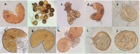 Morfotipos de HMA encontrados en suelos de ca&ntilde;a de az&uacute;car para la producci&oacute;n de panela. a) Glomus microcarpum; b) Glomus fasciculatum; c) Glomus sinuosum; d) Glomus sp.1; e) Glomus sp.2; f) Glomus sp.3; g) Glomus sp.4; h) Funneliformis sp.; i)Acaulospora sp. 1; j) Acaulospora sp. 2. Figure 3: Morphotypes of AMF found in sugarcane soils for panela production. a) Glomus microcarpum; b)Glomus fasciculatum; c) Glomus sinuosum; d) Glomus sp.1; e) Glomus sp.2; f) Glomus sp.3; g) Glomus sp.4; h) Funneliformis sp.; i)Acaulospora sp. 1; j) Acaulospora sp. 2.