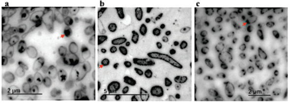 Bioacumulación de metales pesados por TEM en una cepa JM01 aislada de
							rizosfera. a) Pb, b) Cr, y c) Cd.
