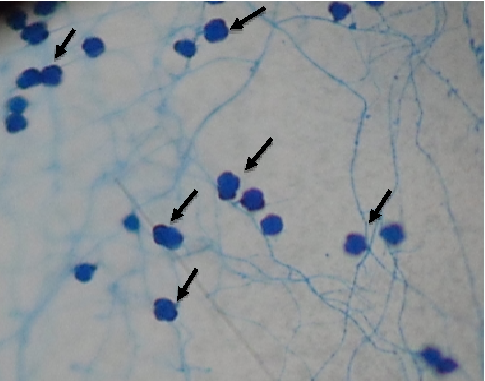 Presencia de clamidosporas de P. chlamydosporia var. catenulata sobre las membranas en el suelo Pardo