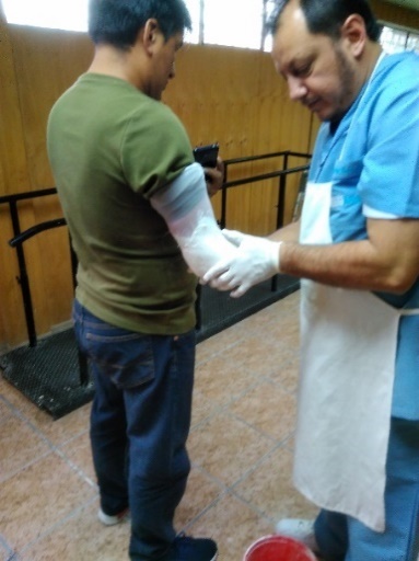 Realización del molde del antebrazo